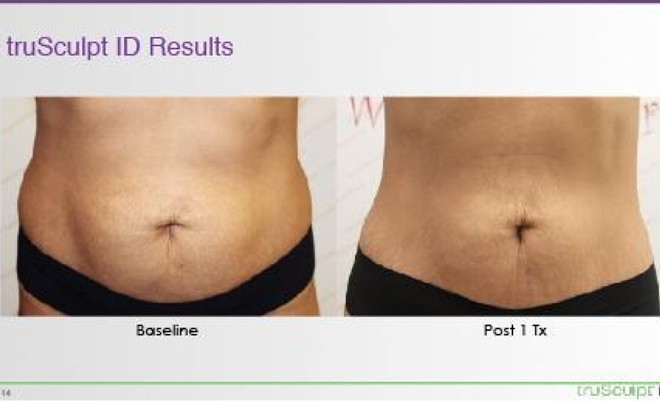 trusculpt obstetrician near me