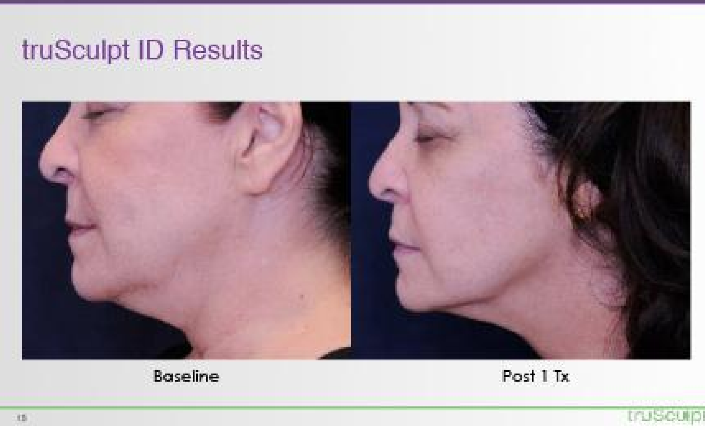 trusculpt obstetrician near me