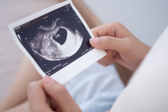 What Can Ultrasounds in Pregnancy Tell Me About My Baby's Health?