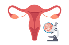 MyoSure-Step-4-end-and-examine