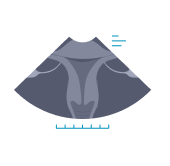 retained-tissue-from-pregnancy-img