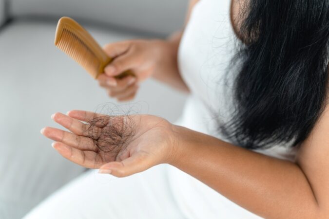 Why Am I Losing Hair and Breaking Out After Giving Birth? Why Am I Losing Hair and Breaking Out After Giving Birth?
